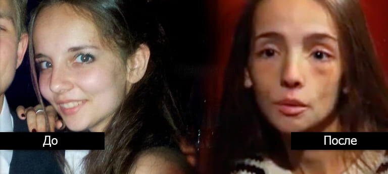 Одно из фото девушек обратившихся к нам в программу после выпуска про 7-Slim