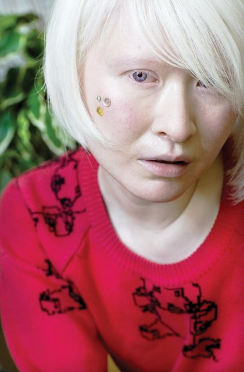 негр и азиат альбинос фото 111