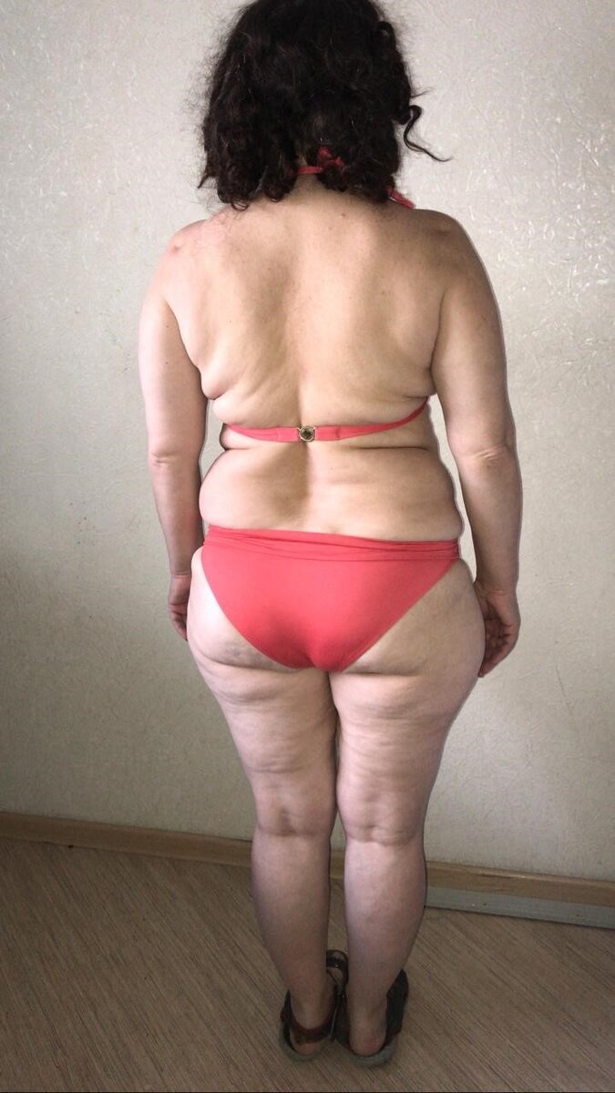 Большие залежи жира в районе спины, слабые мышцы попы, талии, спины. 