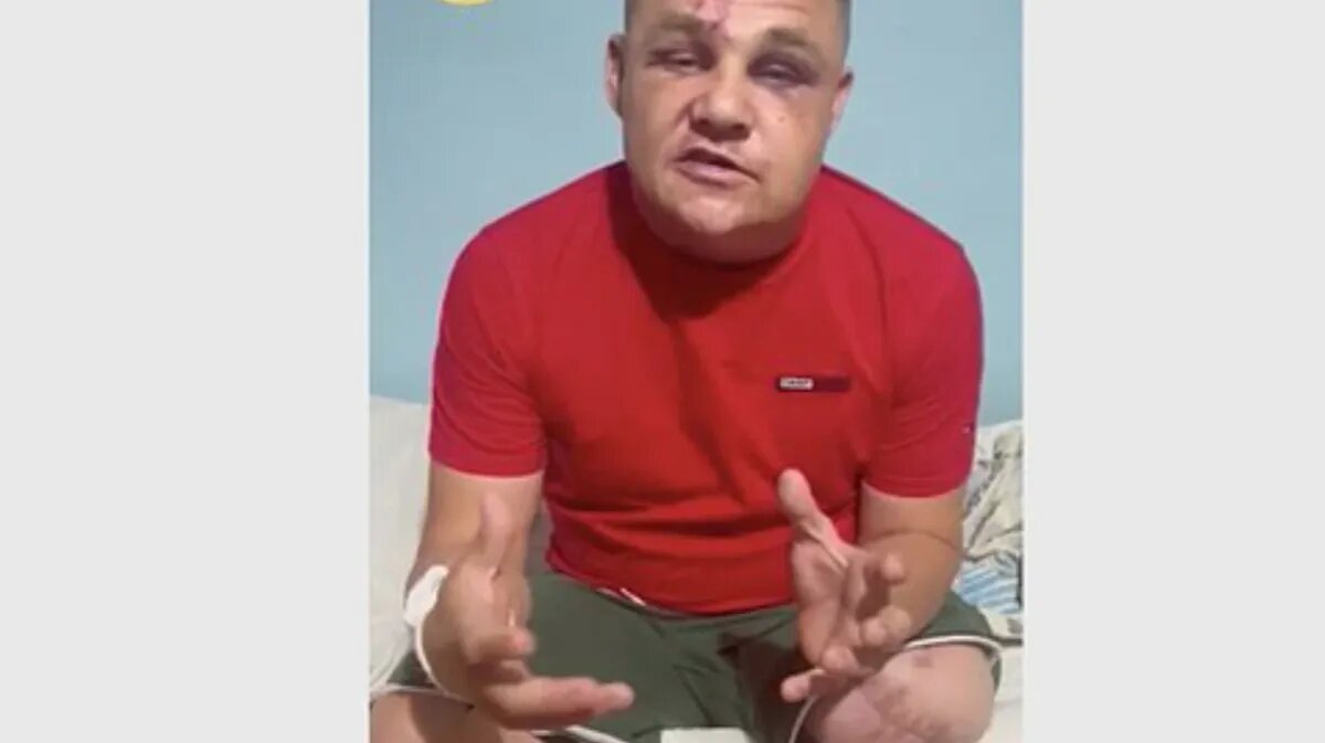 Башаров избил фото. Избиение ветеранов на Украине.
