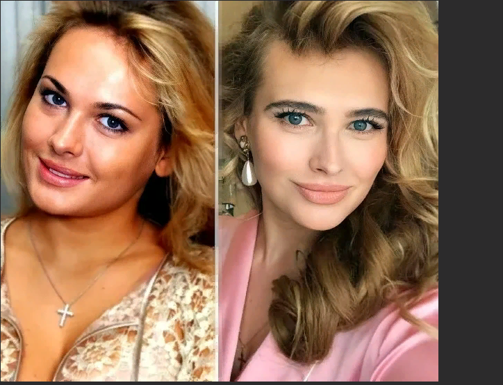 Анна горшкова до и после пластики Как изменились красотки "Бедной Насти": Корикова вернула красоту, а Климова стал