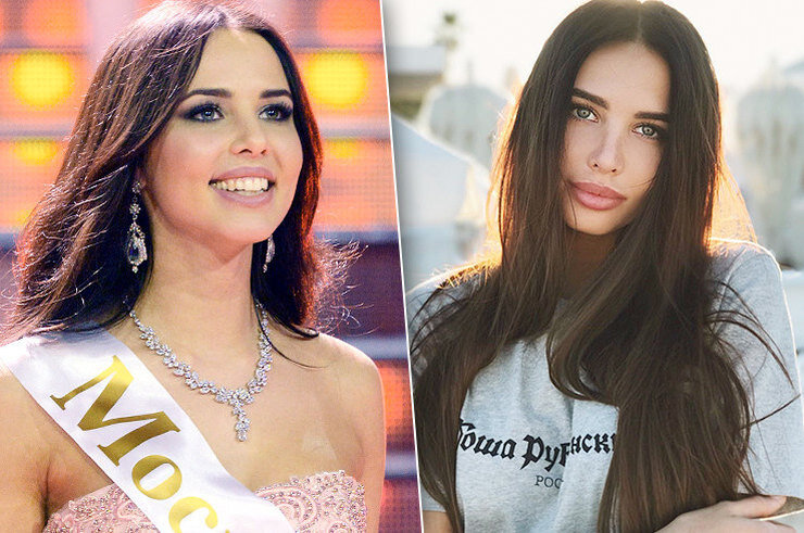 Решетова до и после пластики фото