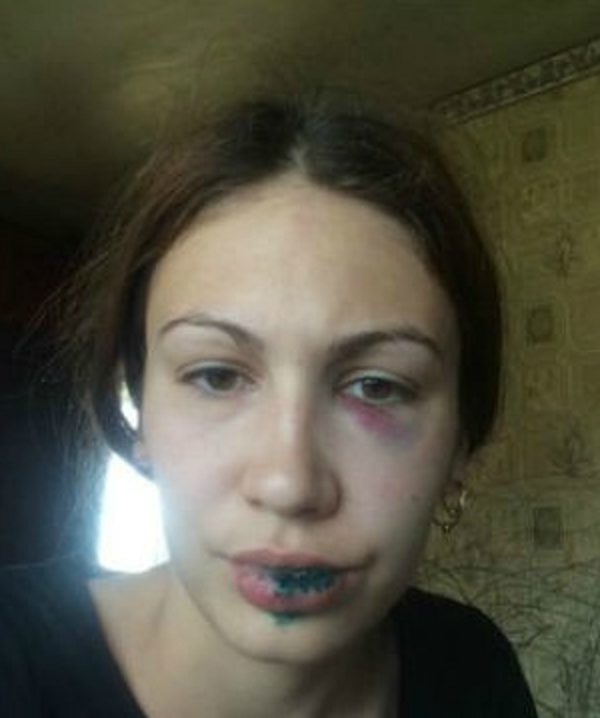 Пострадавшая Надежда Б. 