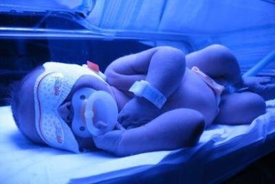Малыш на фототерапии под лампой с синим излучением.