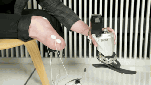 Подвижный протез