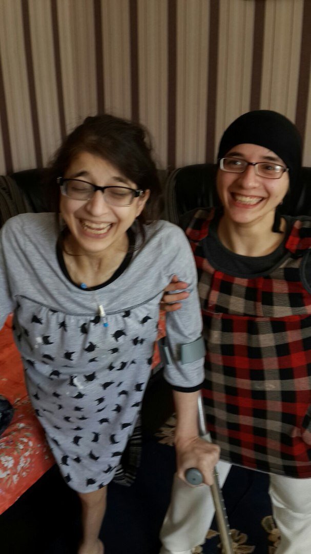Фото зита и гита сиамские близнецы фото