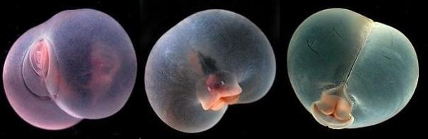 Профиль любой инстаграм барышни. 