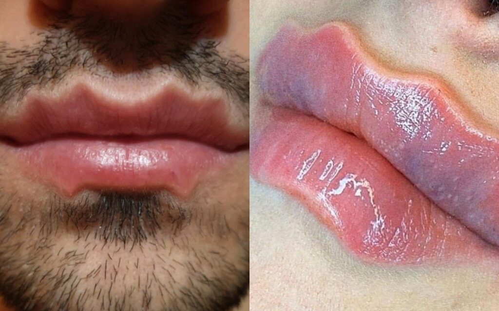 Фото из открытых источников