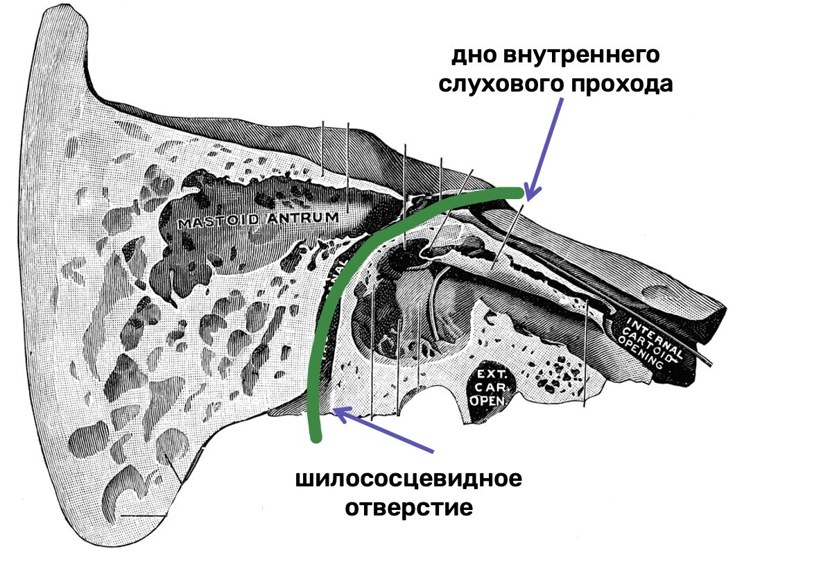 Каналы височного костя. Барабанный каналец височной кости. Мышечно-трубный канал височной кости. Canalis musculotubarius височной кости. Canalis Facialis височной кости.