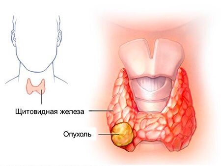 Медицинский центр Наш Доктор, г. Череповец - Хронический простатит