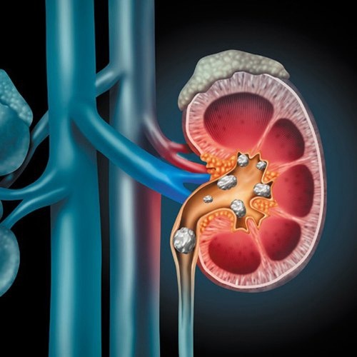 Иллюстрация с сайта kidneyfund.org. 