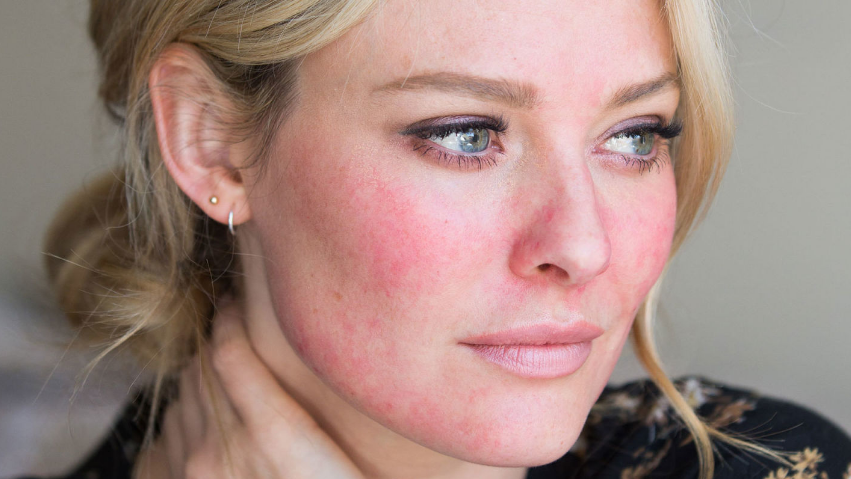 Фото: https://northwestaesthetics.com