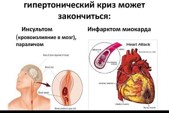 воронежская областная клиническая офтальмологическая больница