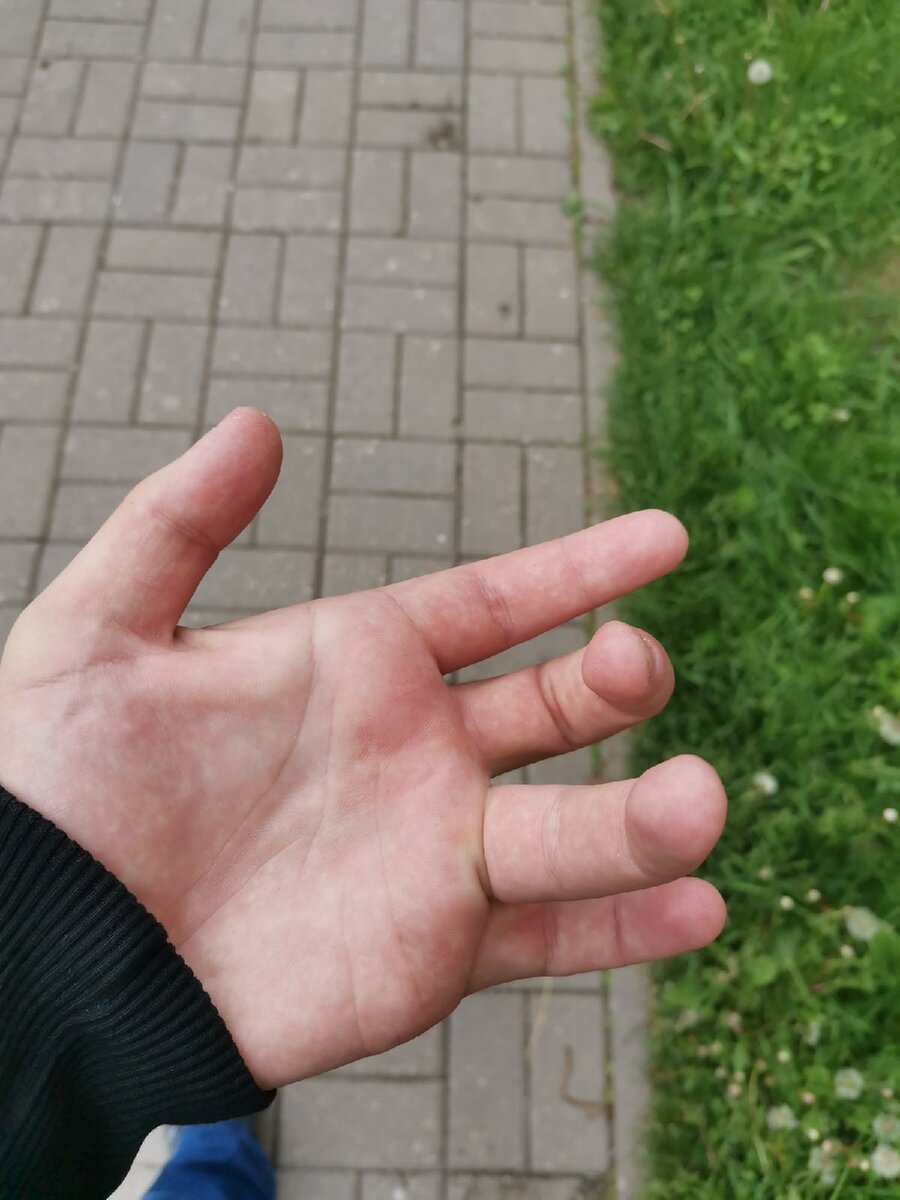 -2
