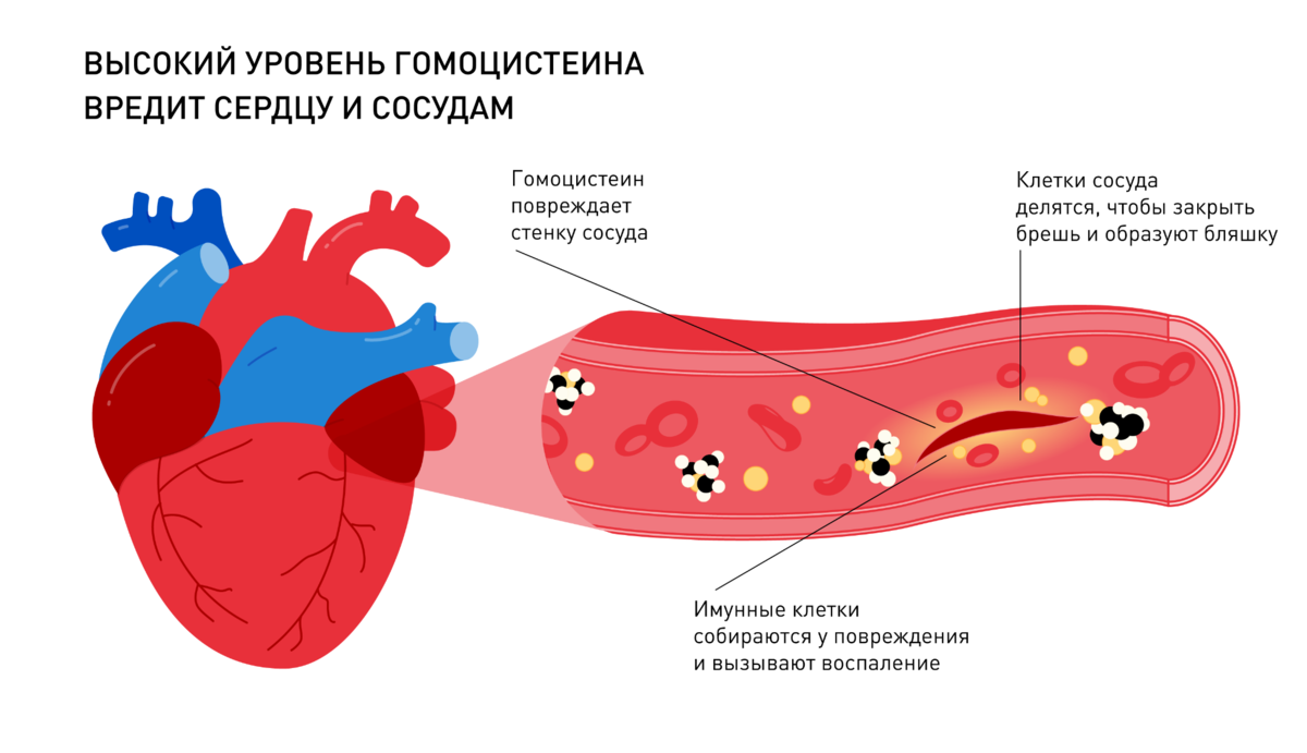 Гомоцистеин это что значит повышенный у женщин. Гомоцистеин. Гомоцистеин повреждает сосуды. Сосуды сердца. Влияние гомоцистеина на сосуды.