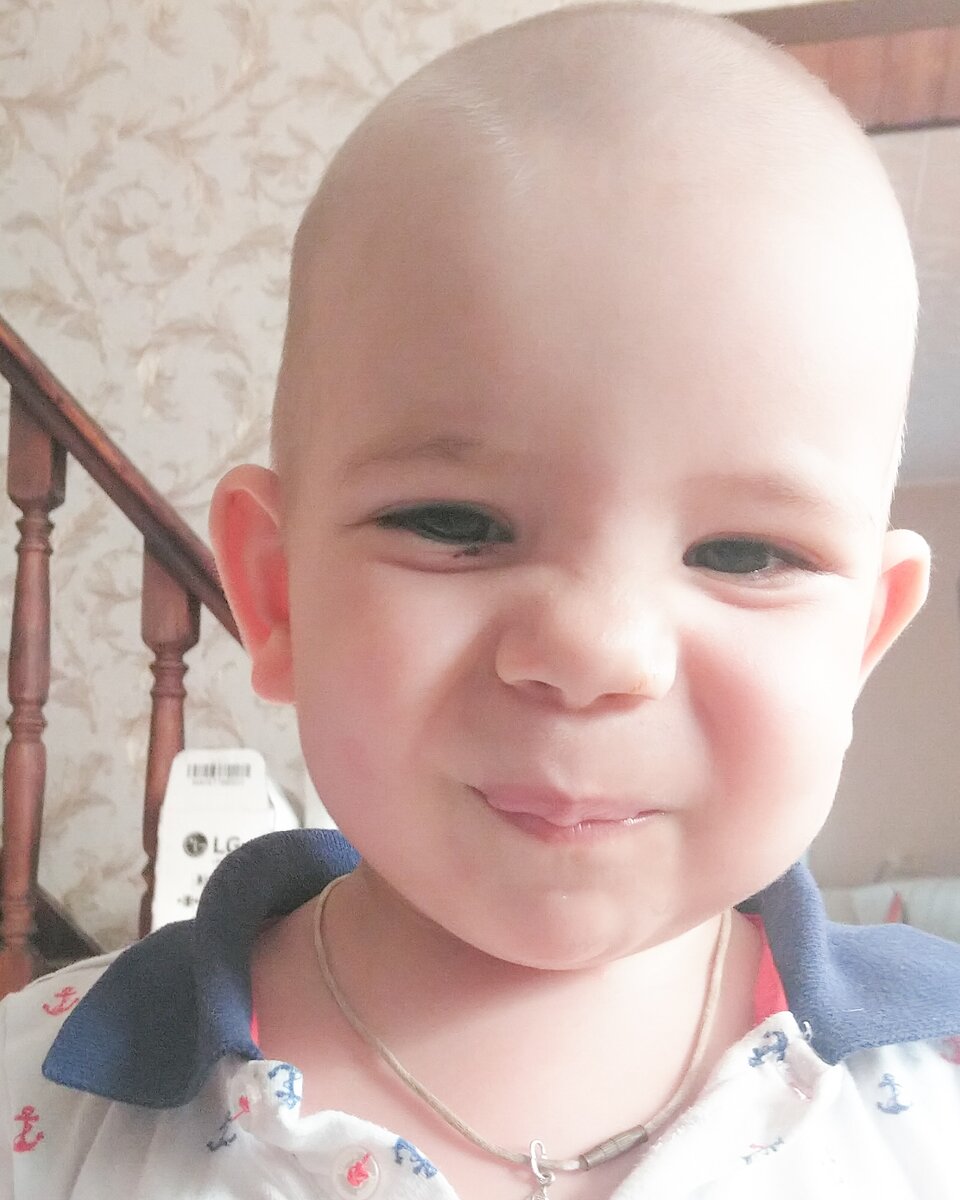 Подбитый глаз- это произошла тесная встреча с углом стола)