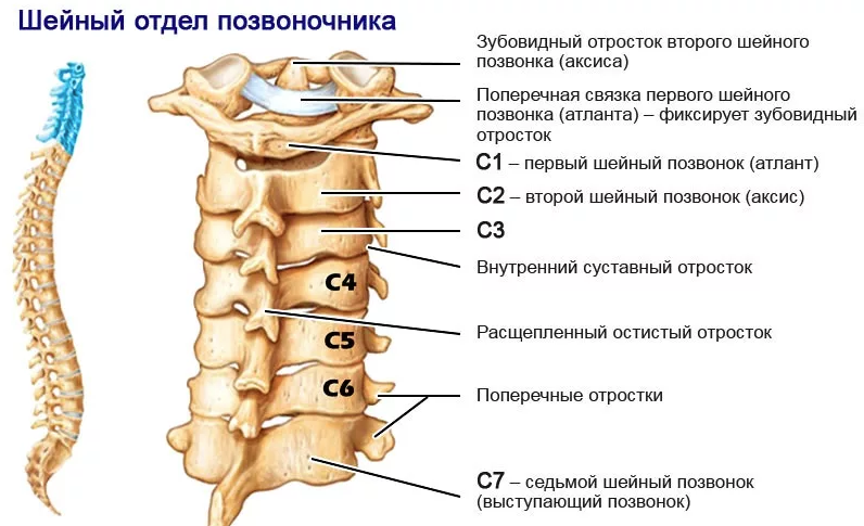 Спондилоартроз шейного отдела