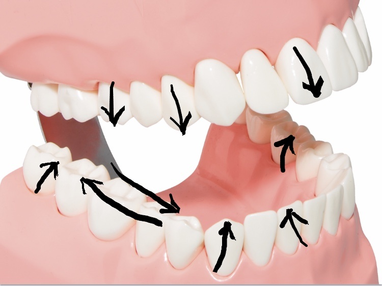 Схематично указала направления чистки щеткой, видно не все поверхности, но по аналогии понятно, и в тексте можно подсмотреть