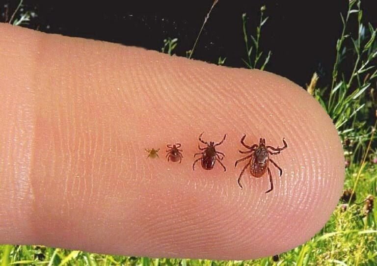 Клещ у ребенка. Источник rostov.media