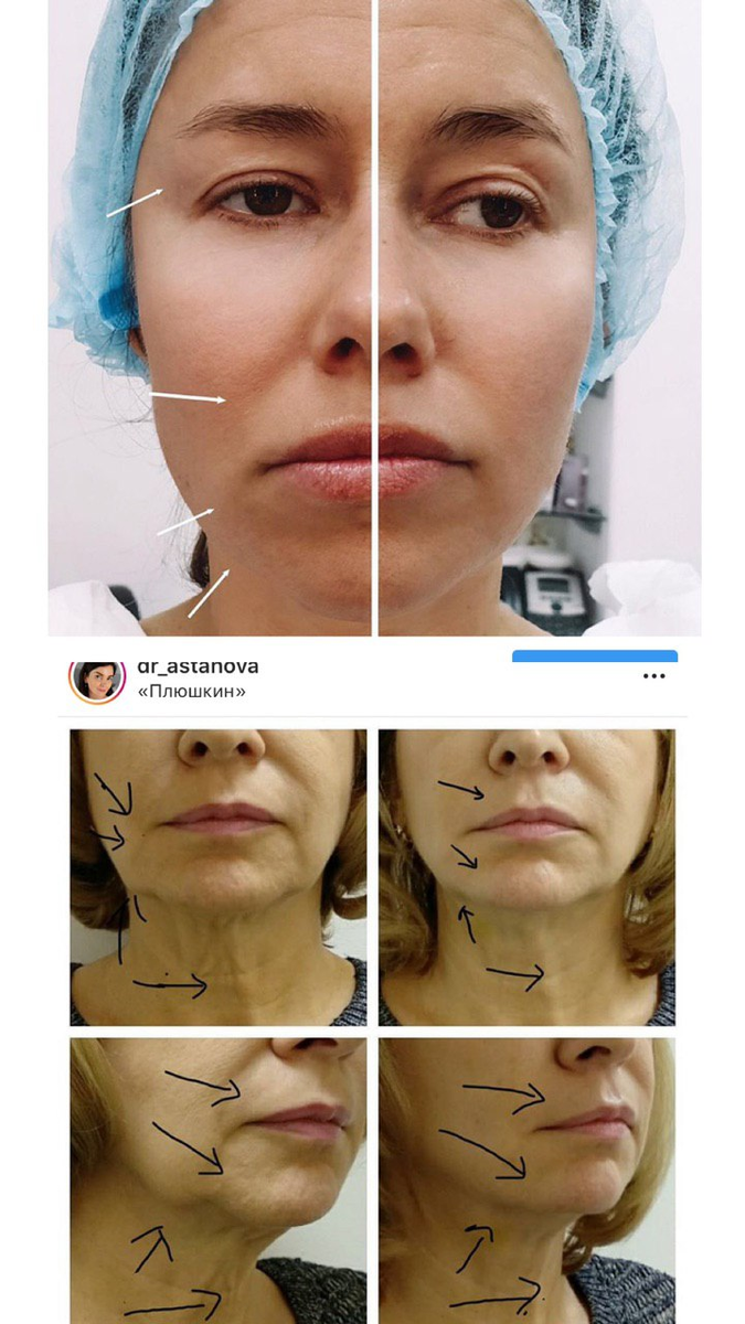 Стрелки для указания изменений от процедуры.