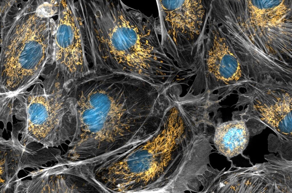    На микрофотографии тканей млекопитающего митохондрии окрашены желтым, клеточные ядра — голубым, цитоскелет — серым / © Torsten Wittmann, University of California, NIH
