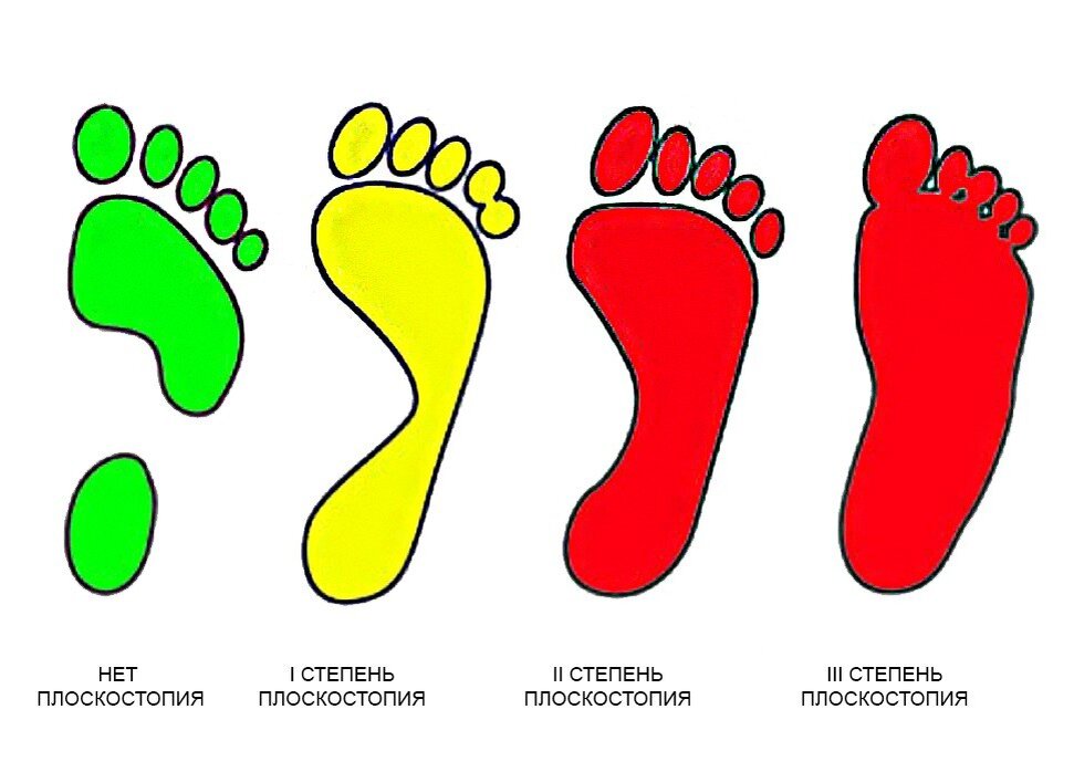 фото с http://medic.ua/wp-content/uploads/2017/07/5555588888_0.jpg