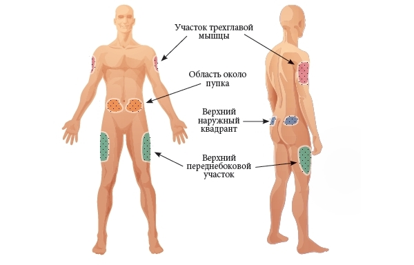 Как сделать укол самому себе | Купрум