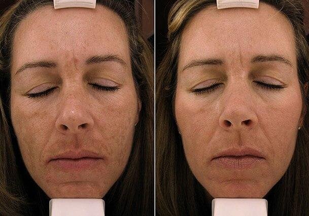 фото из канала отзывов NovAge Татьяны Брик