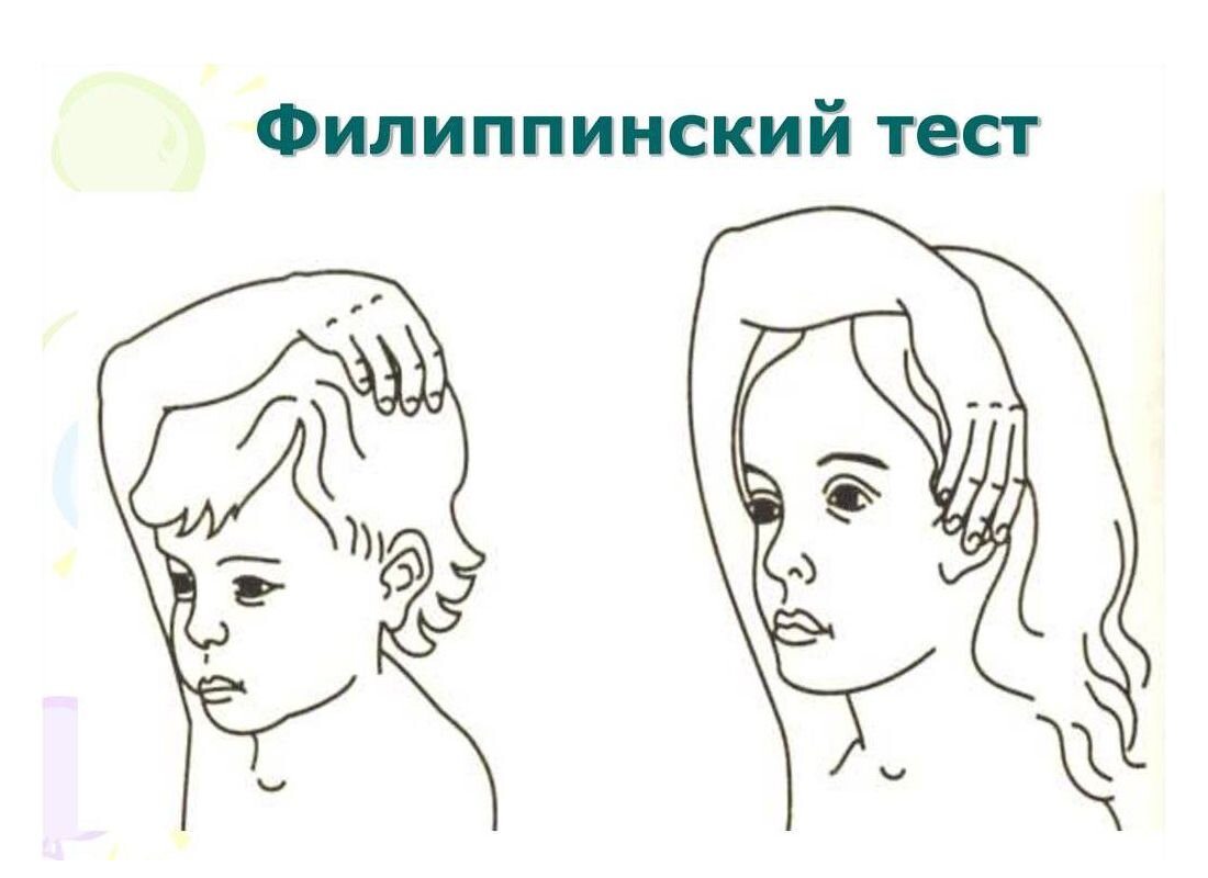 Надо попросить ребенка дотронуться правой рукой до левого уха, проведя руку над головой.