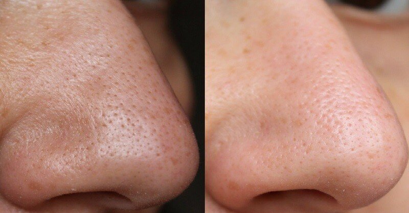 До и после применения маски