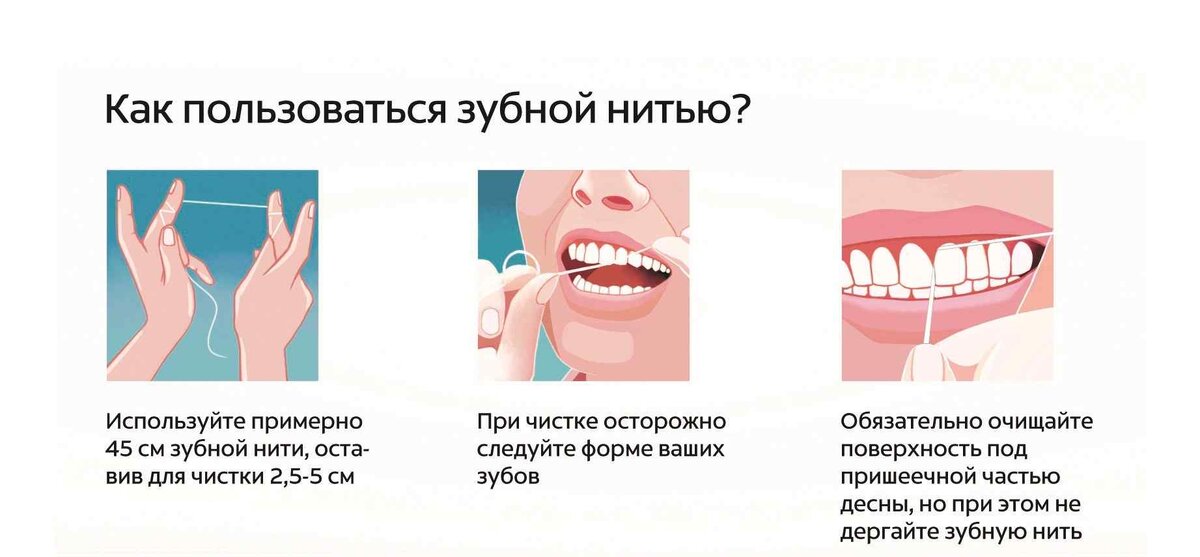 Для правильного использования зубной нити рекомендуется проконсультироваться со стоматологом
