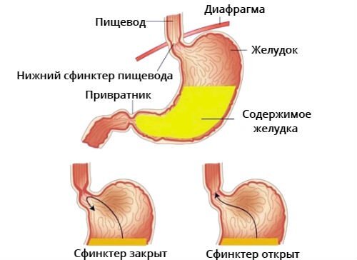 Повреждение слизистой оболочки желудка