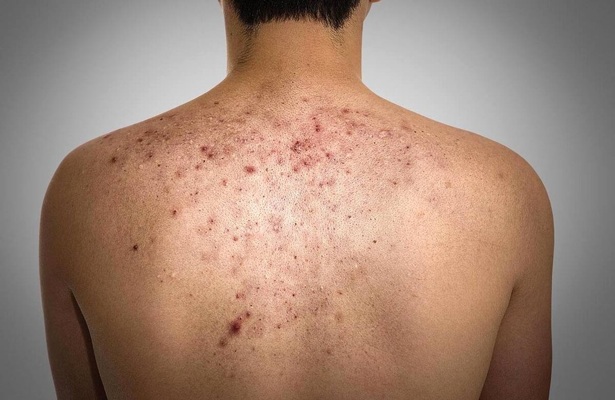 Фото взято из интернета