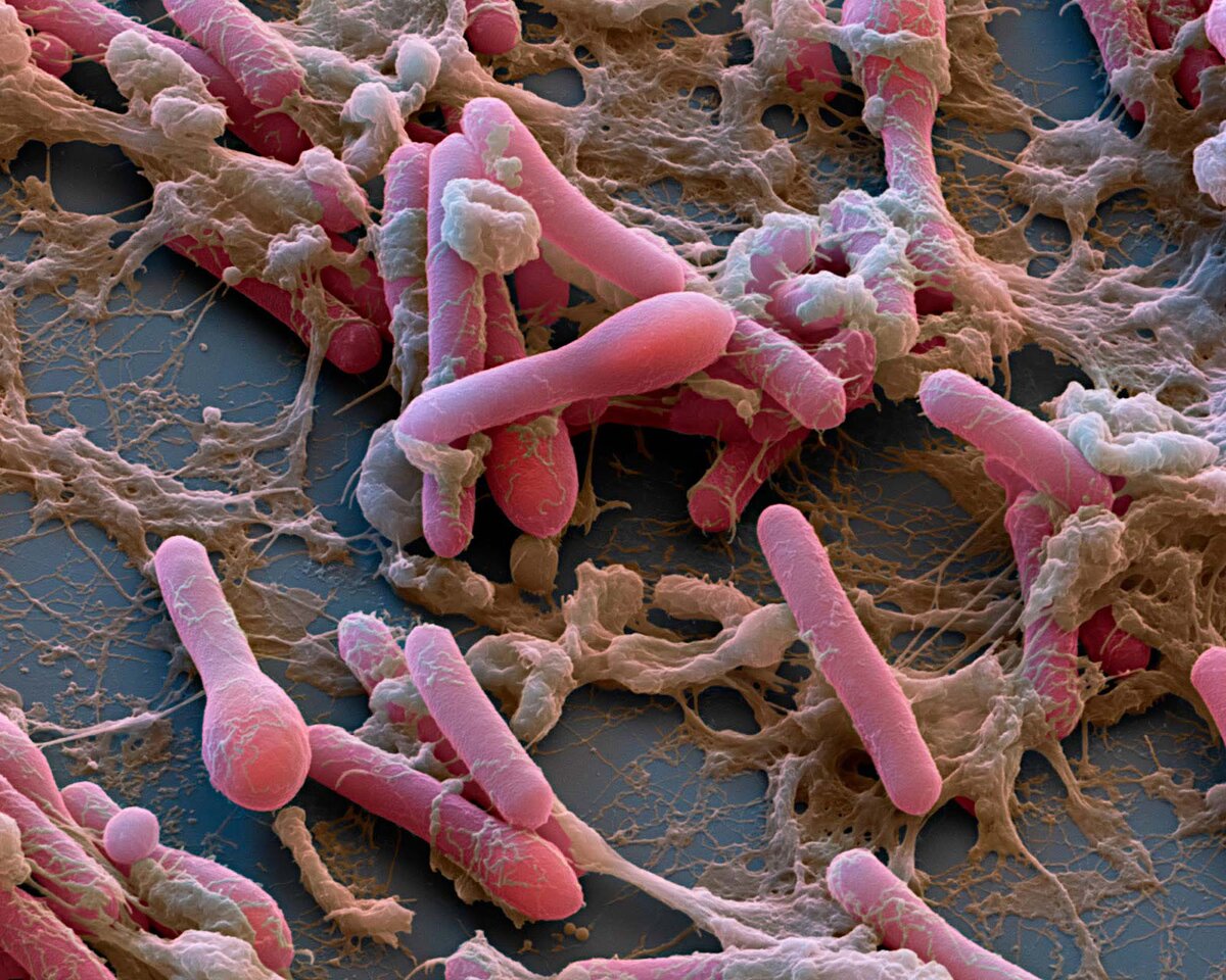  Clostridium botulinum