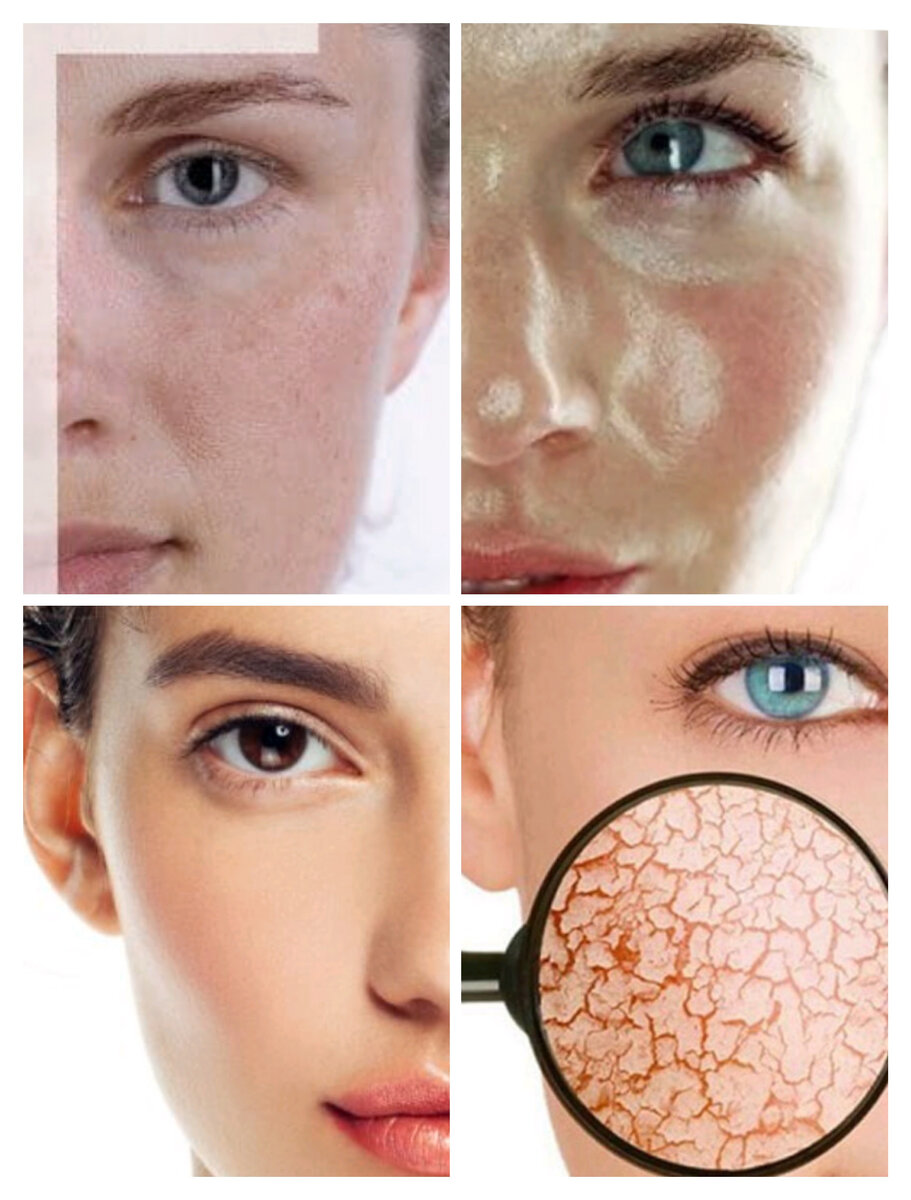 Существует 4 типа кожи, и у каждого из них свои особенности в уходе