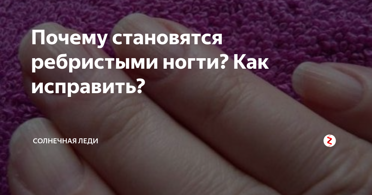 Почему ногти становятся ребристыми вертикально. Почему ногти становятся ребристыми. Почему ногти на руках ребристые. Ногти становятся ребристыми причины у женщин на руках. Почему ногти стали ребристыми.