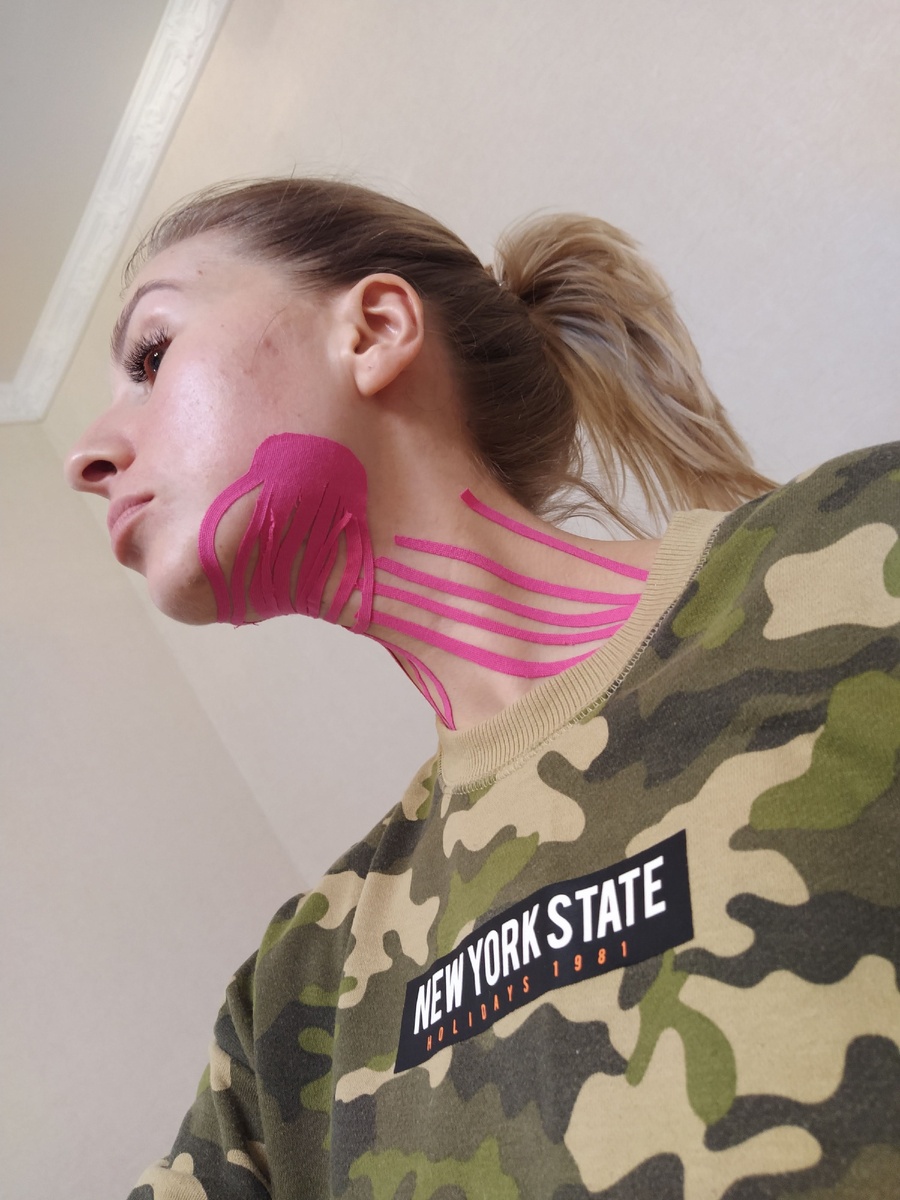 Эстетическое тейпирование