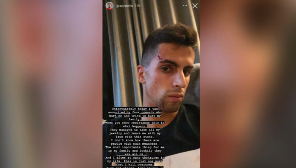 Жоао Канселу после нападения