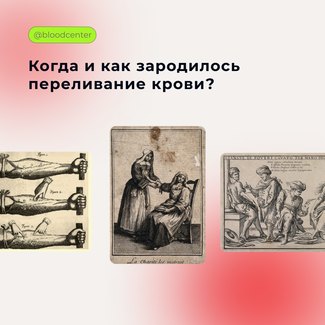 Когда и как зародилось переливание крови | Центр крови имени О.К. Гаврилова  ДЗМ | Дзен