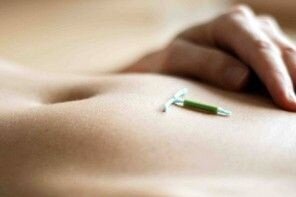 Фото http://www.onclinic-ryazan.ru/lechebnyj-tsentr/gynecology/intrauterine-device/