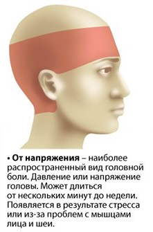 Кепка давит на мозги. Головная боль. Стресс головная боль. Стрессовая боль в голове. Сильная головная боль от стресса