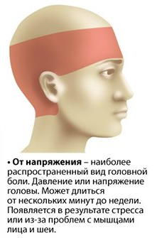 Кепка давит на мозги. Головная боль. Стресс головная боль. Стрессовая боль в голове. Сильная головная боль от стресса.