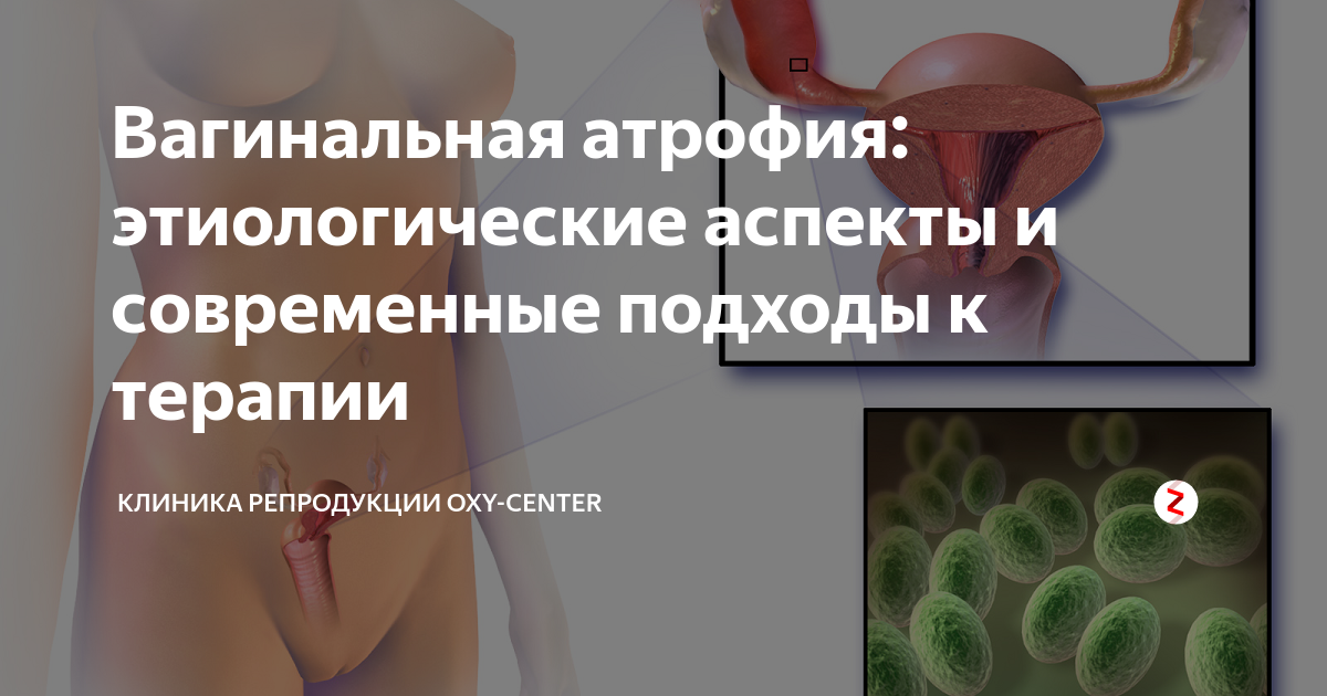 Вагинальная атрофия: современные подходы к лечению - OXY-Center