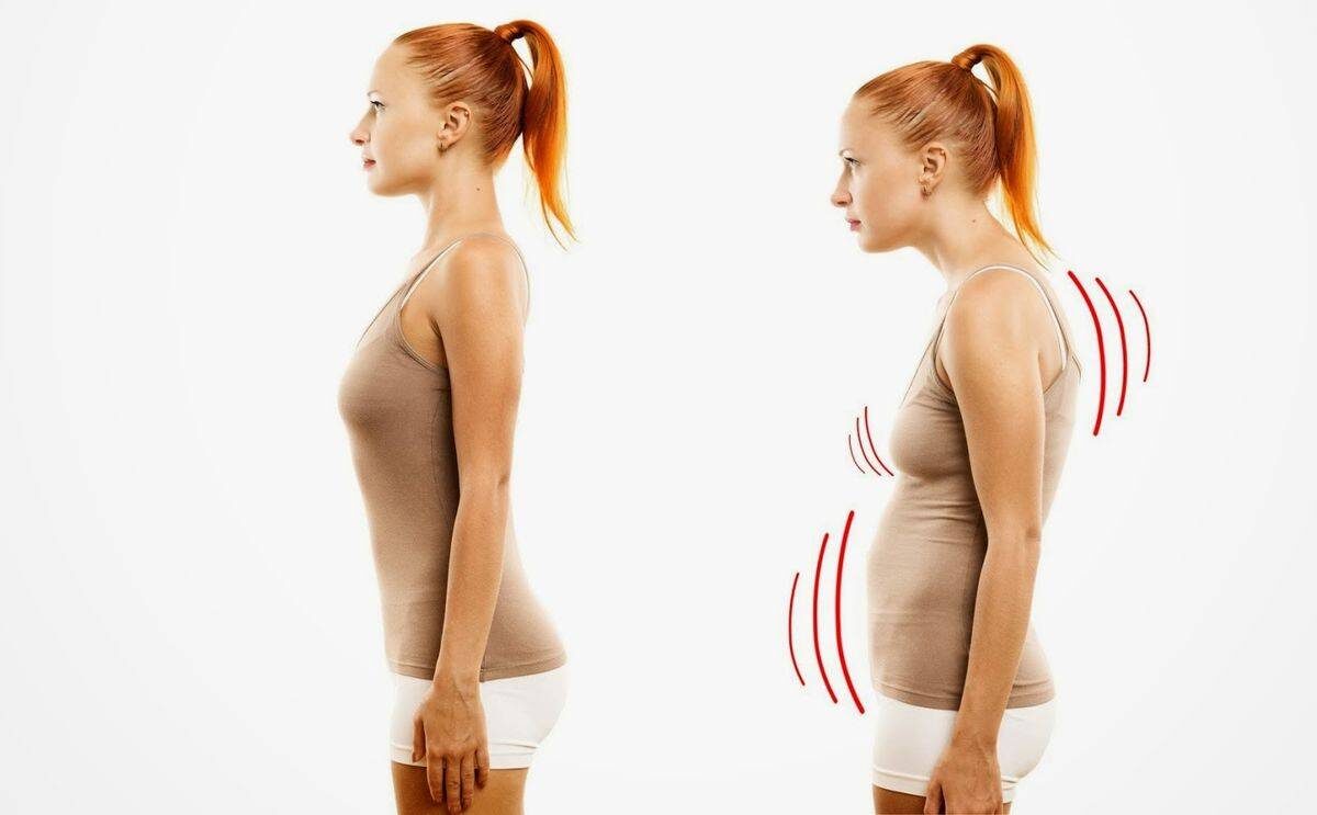 Источник фото: https://ladyslimfit.ru/gym/115-uprazhneniya-dlya-osanki.html