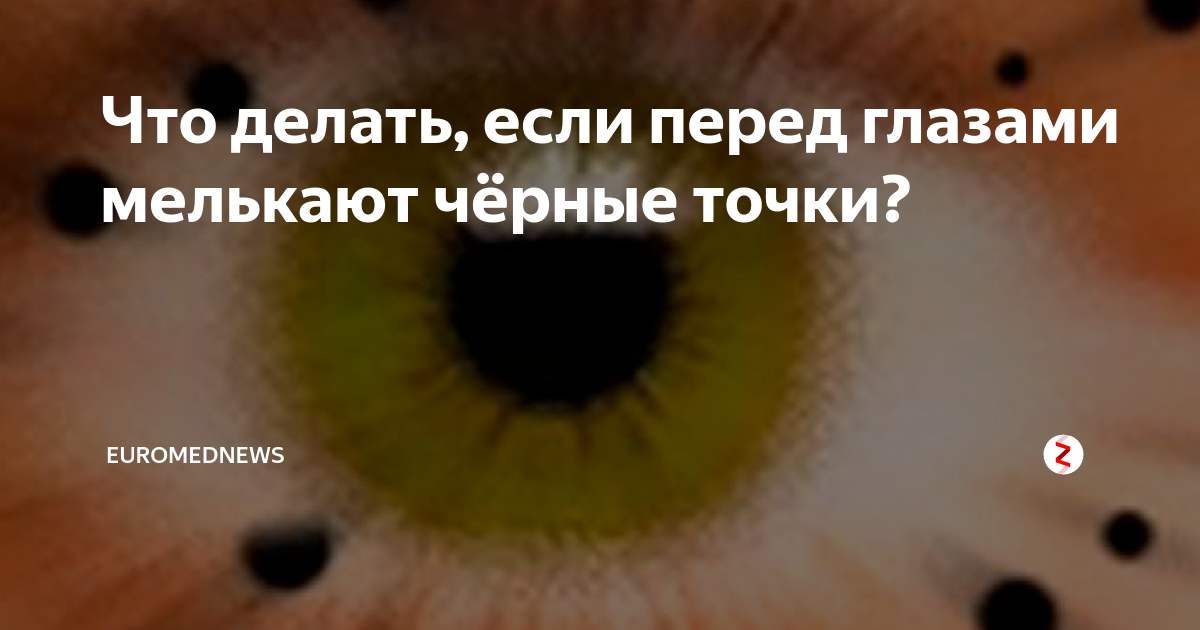 Перед глазами песня. Чёрные точки перед глазами. Чёрные точки в глазах причины. Чёрные точки перед глазами причины. Чёрные пятна точки перед глазами.