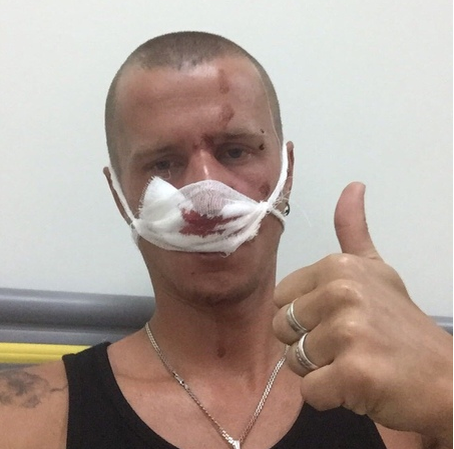 Вот и сам пострадавший.