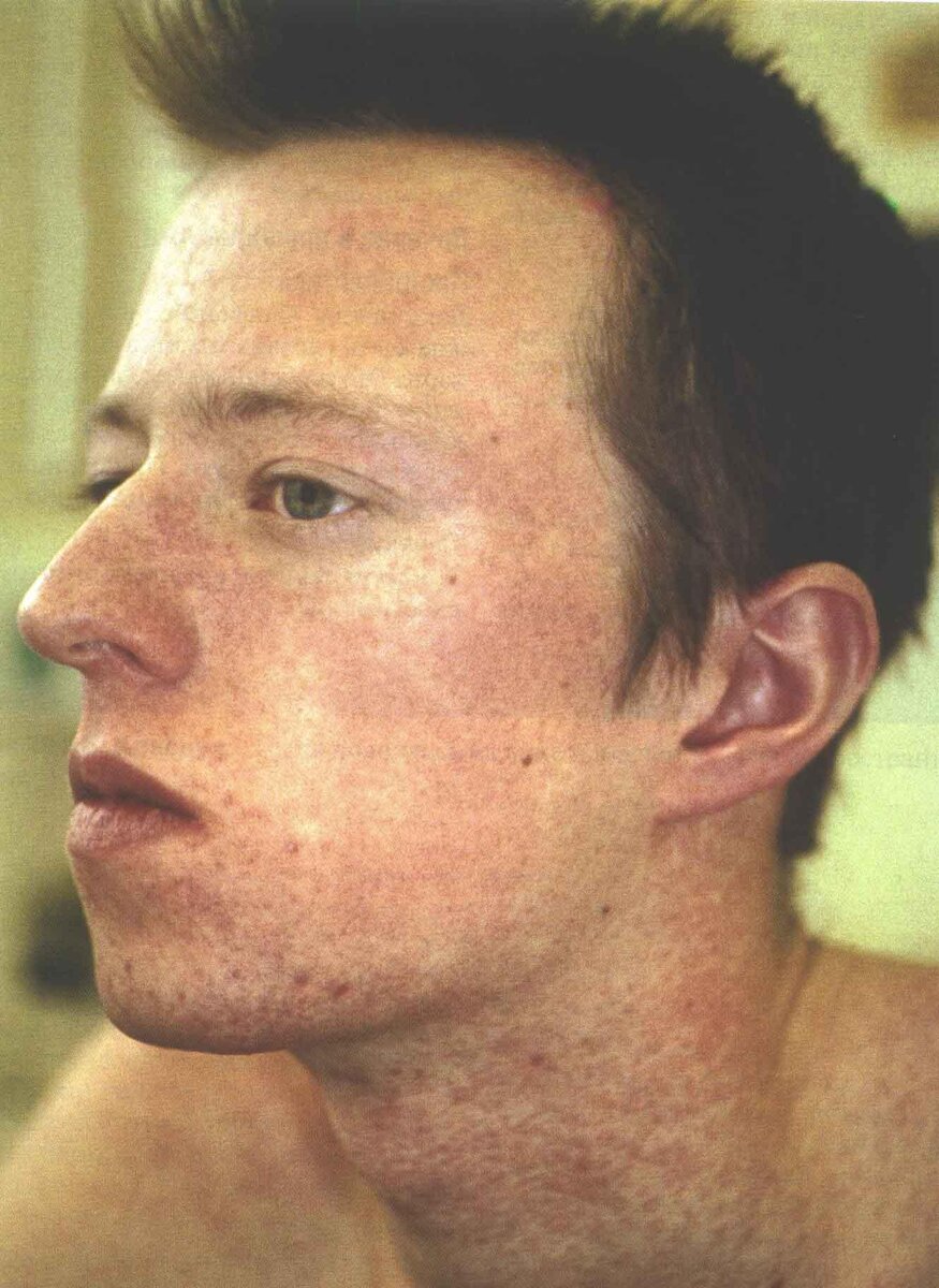 Фотография находится в свободном пользовании сети интернет.