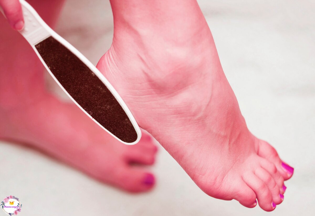 Ноги, сухие пятки, грибок ног 