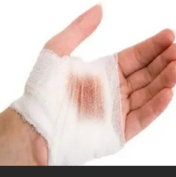 Что будет если посыпать соль на рану? | Crub | Дзен