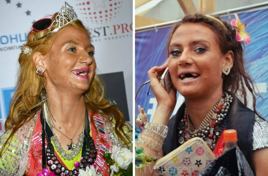 Светлана Яковлева считает отсутствие передних зубов - своей фишкой 